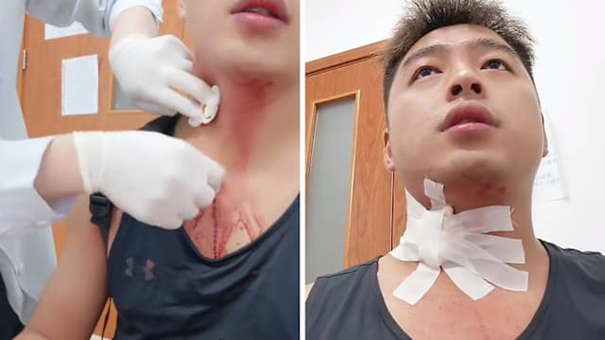 Câu Chuyện Hy Hữu Về Cơn Ngứa: Người Đàn Ông Gặp Biến Chứng Từ Muỗi Đốt